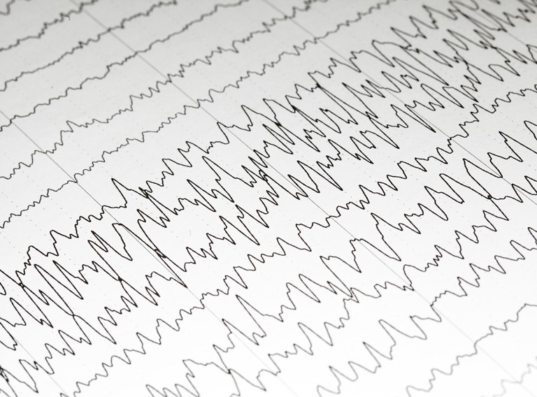 Electroencefalograma
